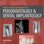 Critical Decisions in Periodontology and Dental Implantology- Hall`s - 2013