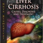 Liver Cirrhosis: Causes, Diagnosis, and Treatment - 2011