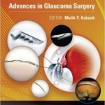 MIGS: Advances in Glaucoma Surgery - 2014
