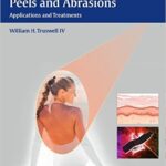 Lasers and Light, Peels and Abrasions: Applications and Treatments - 2016