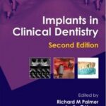 Implants in Clinical Dentistry - 2012