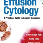 Effusion Cytology: A Practical Guide to Cancer Diagnosis - 2011