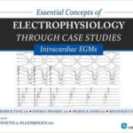 Essential Concepts of Electrophysiology through Case Studies: Intracardiac EGMs - 2015