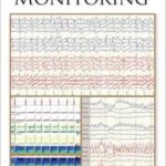 Handbook of ICU EEG Monitoring - 2013