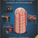 Ultrasound Evaluation of Focal Neuropathies: Correlation with Electrodiagnosis - 2014