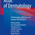 Atlas of Dermatology: Inflammatory, Infectious and Tumoral Skin Diseases - 2022