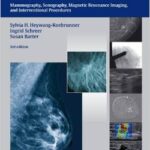 Diagnostic Breast Imaging: Mammography, Sonography, Magnetic Resonance Imaging, and Interventional Procedures - 2014