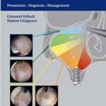 Sinonasal Complications of Dental Disease and Treatment: Prevention - Diagnosis - Management - 2016