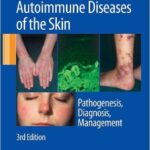 Autoimmune Diseases of the Skin: Pathogenesis, Diagnosis, Management - 2011