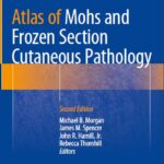 Atlas of Mohs and Frozen Section Cutaneous Pathology - 2018