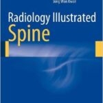 Radiology Illustrated: Spine - 2014