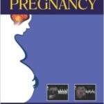 Hypertensive Disease in Pregnancy - 2014